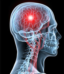 neurosurgery_layout